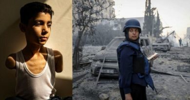 Portreti i djalit nga Gaza, i cili humbi të dy krahët në sulmin izraelit, është zgjedhur Fotoja e Vitit në World Press për vitin 2025
