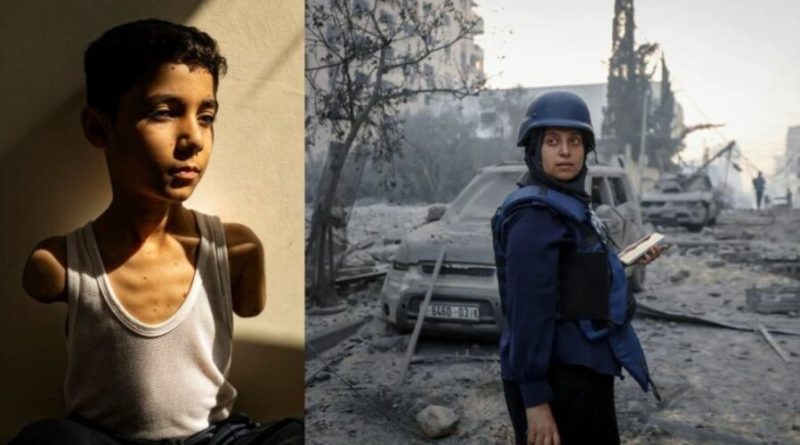 Portreti i djalit nga Gaza, i cili humbi të dy krahët në sulmin izraelit, është zgjedhur Fotoja e Vitit në World Press për vitin 2025